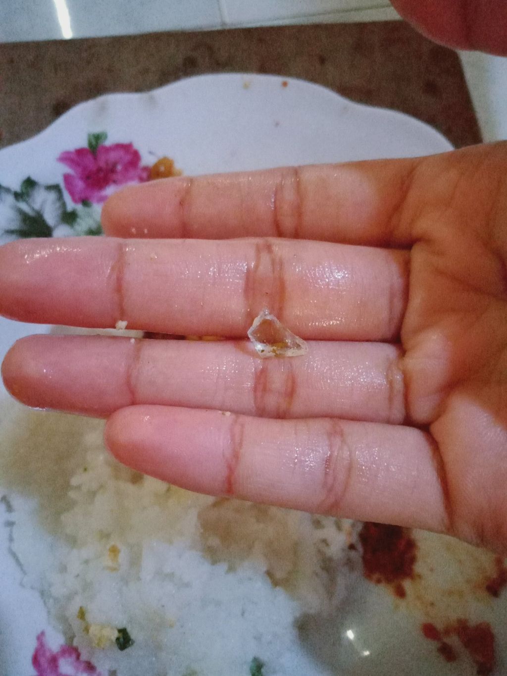 Duh! 5 Netizen Ini Temukan Benda Berbahaya dalam Makanannya