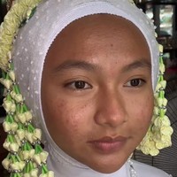 Sebelum di makeup wajah sang wanita terlihat pucat dan berkulit lebih gelap. Beberapa noda bekas jerawat pun tampak menghiasi wajah sang wanita. Foto: Instagram/@tangancantikputri