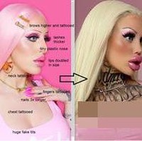 Salah satu perubahan paling ekstremnya adalah di bagian bibir dan payudara.Foto: Instagram @alicia_amirax