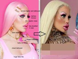 Perubahan Drastis Wanita Terobsesi Jadi Barbie, Tak Dikenali Setelah 3 Tahun