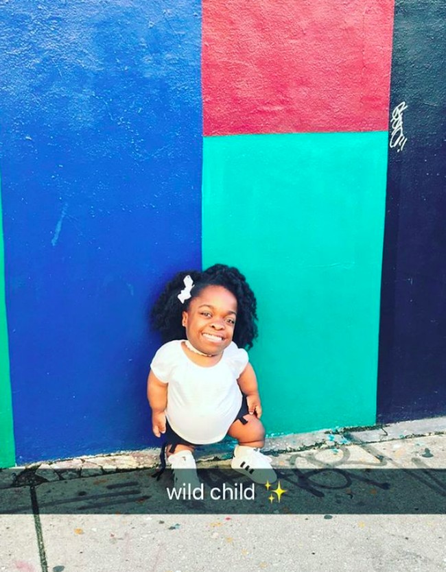 Wildine mengaku bahwa dia memanfaatkan media sosialnya untuk membantu memecah stigma tentang manusia kerdil. Foto: dok. Instagram/@wavy.wildine