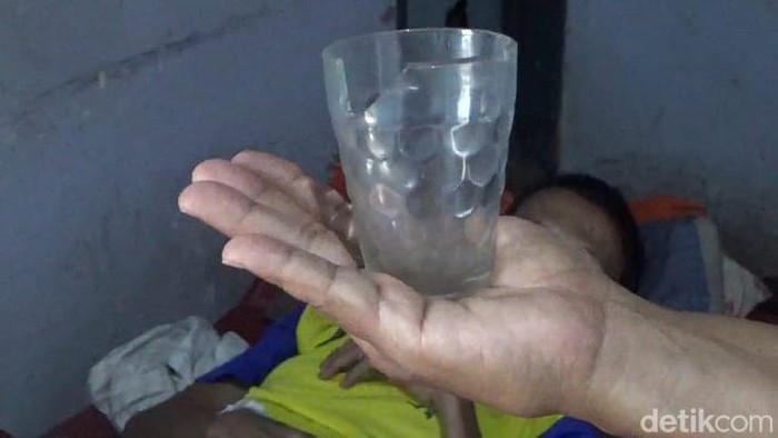 Gelas dalam perut Perut pria di jember ada gelas