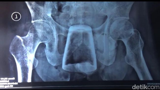 Anal porno pizza yetkazib berish