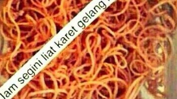 Ketika karet gelang seperti mie goreng. Foto: Twitter