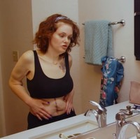 Tidak ada lagi daging menggelambir. Kulit di area perutnya pun sudah terangkat sehingga kini lebih kecil. Foto: dok. Youtube/TLC UK