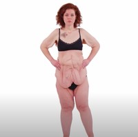 Ketika Anna mencapai berat badan yang diinginkan, dia tidak merasa bahagia. Anna merasa sedih dan jijik dengan kelebihan kulitnya. “Aku merasa menjijikan dan aku membenci tubuhku,” akunya. Foto: dok. Youtube/TLC UK