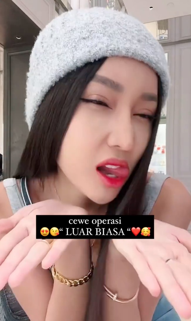 Lucinta juga menjelaskan apa yang dimaksud dengan operasi ganti kepala yang dijalaninya. Kepala gue nih ya, kepala gue nih di belek nih ya. Dibuka topeng muka gue. Semua itu dipotong-potong yang ada di tengkorak-tengkorak gue, terus dimasukkin benda-benda apalah. Pokoknya intinya kepala gue kepala baru, jelas Lucinta. Foto: Instagram/@lucintaluna_manjalita