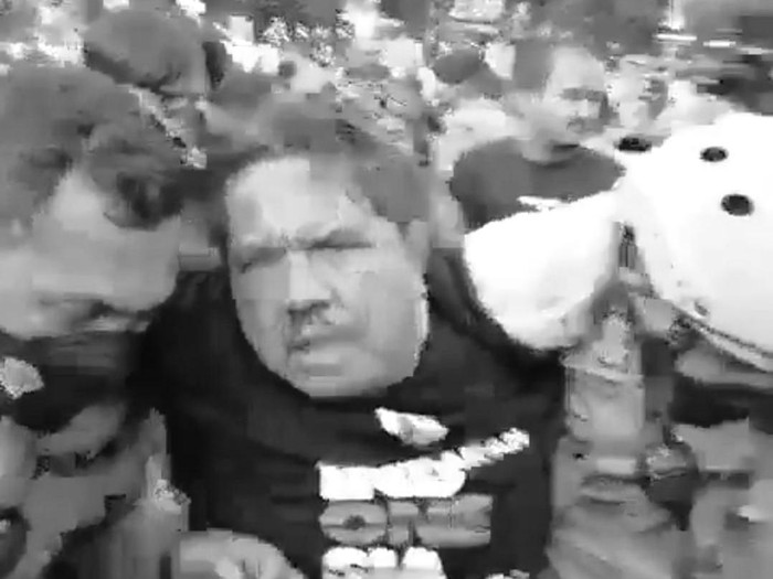 Ade Armando menjadi korban pengeroyokan di tengah-tengah aksi 11 April di Jalan Gatot Subroto, Jakarta. Dia mengalami luka cukup parah. (dok ist)