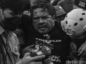 Kondisi Terkini Ade Armando yang Alami Pendarahan Otak-Kandung Kemih