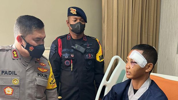 Kapolda Metro Jaya Irjen Fadil Imran menjenguk polisi korban demo 11 April