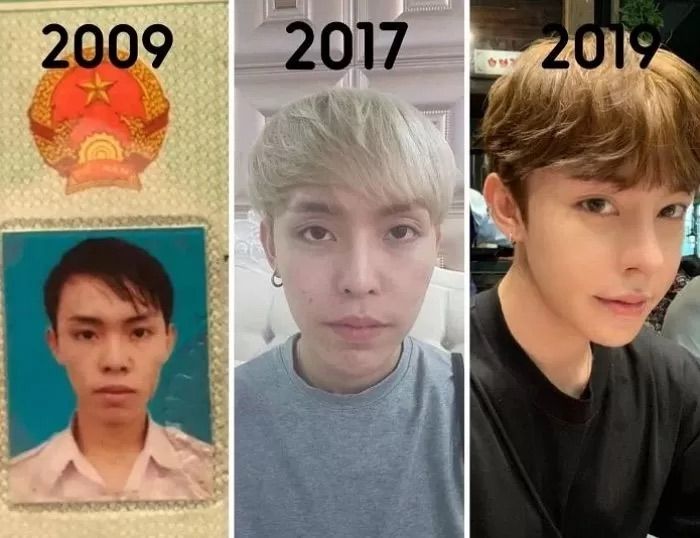 Pria Vietnam Ini Dicap Jelek, Oplas Belasan Tahun Hingga Mirip Idol KPop