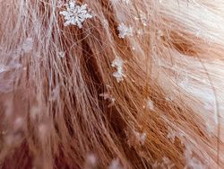 Karya Jawara Kontes Foto Makro Apple yang Memukau Mata