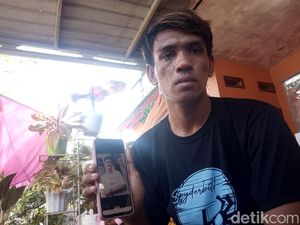 Warga Gowa Ditembak KKB Papua Masih Koma, Tak Bisa Pulang-Butuh Rp 100 Juta