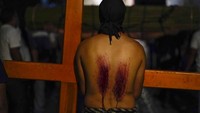 Ranting berduri ini mengibaratkan penderitaan Yesus.  