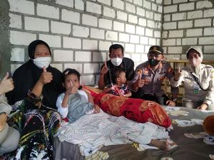 Kondisi Terkini Sinta Penderita Tumor Tulang yang Operasinya Dibiayai Kapolri