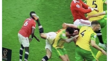 Di pertandingan yang sama, Harry Maguire masih saja jadi sorotan. Terbaru, ia bikin kepala Paul Pogba berdarah. Foto: Twitter