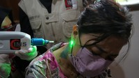 Teknik hapus tato menggunakan sinar laser. Puluhan peserta tersebut hadir dari berbagai latar belakang.  