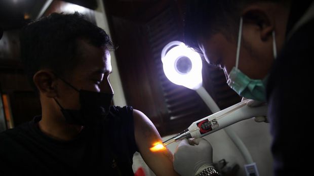 Peserta mengikuti kegiatan hapus tato gratis di Kantor DPP FUHAB, Kebayoran Baru, Jakarta Selatan, Selasa (19/4/2022).