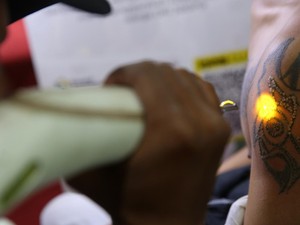 Ragam Usaha Hapus Tato Penuh Risiko: Pakai Serbuk PK hingga Disetrika