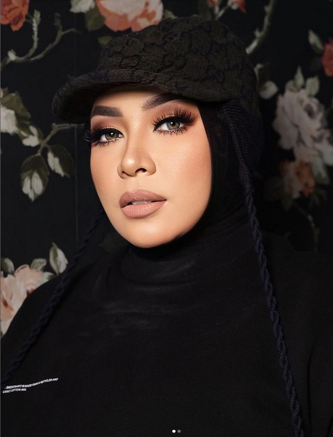 Penyanyi dan pencipta lagu itu juga mengatakan bahwa pipinya yang tampak jauh lebih tirus berkat sedot lemak di area pipi atau Buccal Fat. Foto: Dok. Instagram @melly_goeslaw.