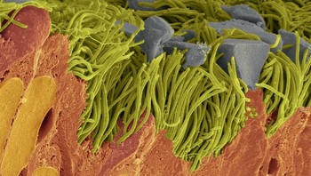 Lapisan bronkiolus Foto: Brightside