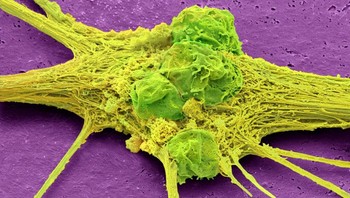Neuron yang diturunkan dari sel punca Foto: Brightside