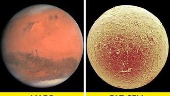 Sel lemak yang terlihat seperti Mars Foto: Brightside