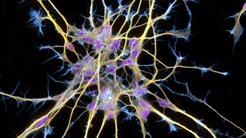 Neuron dari sel induk Foto: via Brightside