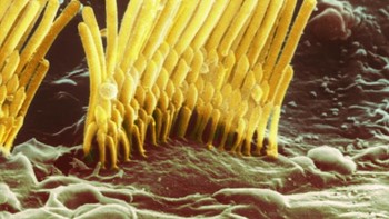 Sel rambut luar dari organ Corti di koklea telinga bagian dalam manusia Foto: via Brightside