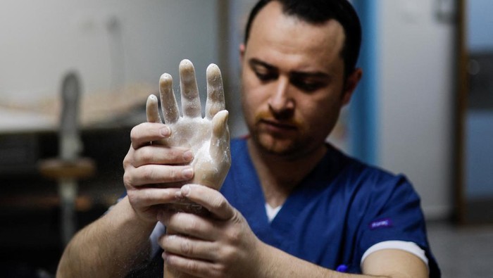 Potret Pria Palestina Pakai Tangan Palsu Canggih Usai Jadi Korban Serangan Israel A Palestinian technician prepares a myoelectric limb at the Sheikh Hamad Bin Khalifa Al Thani Rehabilitation and Prosthetics Hospital in the northern Gaza Strip April 13, 2022. Picture taken April 13, 2022. REUTERS/Mohammed Salem