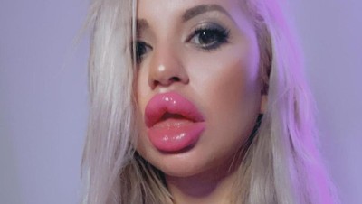 8 Foto Wanita Terobsesi Oplas Payudara Hingga Ukuran K, Kini Tak Diakui Ortu