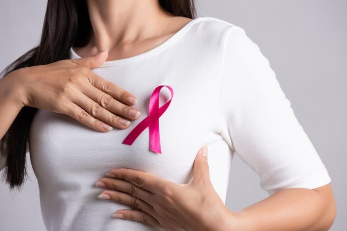 Ilustrasi kanker payudara