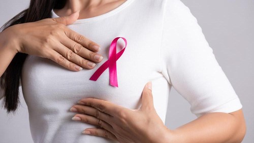 Ilustrasi kanker payudara