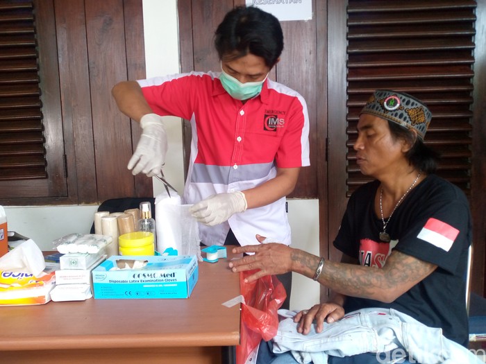 Menghapus tato dengan laser Menghapus tato dengan laser