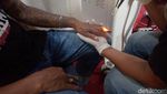 Perjuangan Hapus Tato, Ditembak Laser hingga Disetrika-Ditaburi Bubuk PK