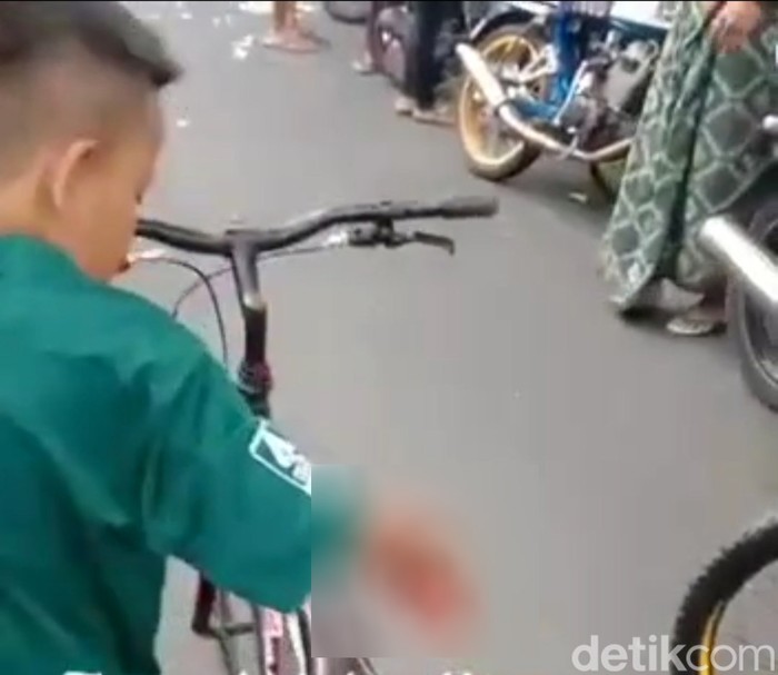 Viral video anak tangannya terluka diduga karena petasan.