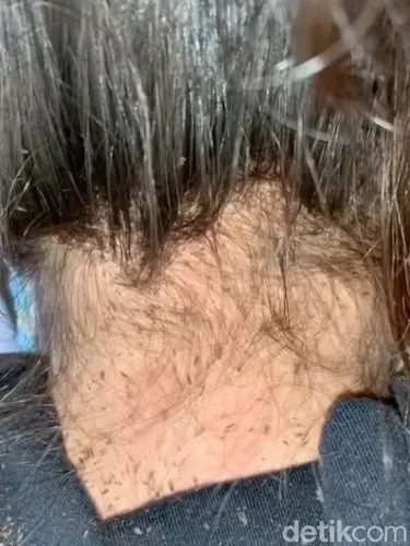 Penata rambut viral temukan kutu di kepala terbanyak sepanjang kariernya.