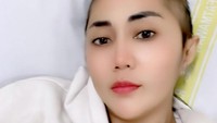 Rambut Aida Saskia terlihat sedikit habis saat diperlihatkan dalam Instagram miliknya. Foto: Instagram Aida Saskia