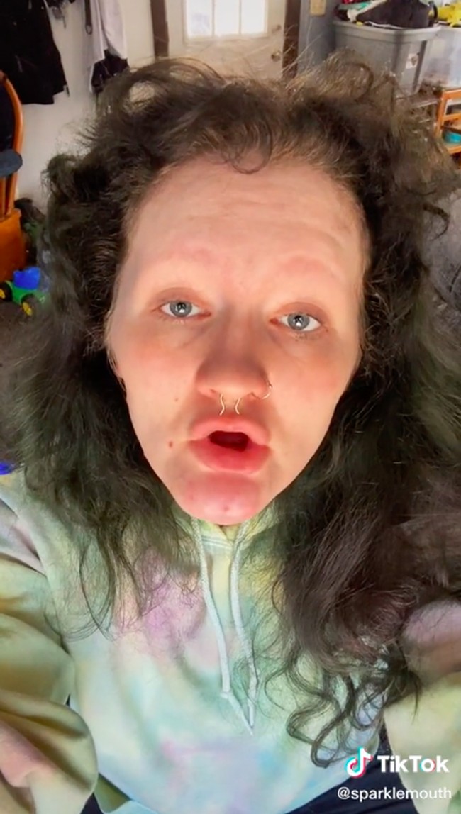 Selain tidak memiliki gigi, Alyssa pun tidak punya alis. Dan wanita yang kerap vokal membahas tentang body positivity di akunnya itu menunjukkan pula kondisi wajahnya tanpa alis. Foto: dok. TikTok