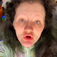 Selain tidak memiliki gigi, Alyssa pun tidak punya alis. Dan wanita yang kerap vokal membahas tentang body positivity di akunnya itu menunjukkan pula kondisi wajahnya tanpa alis. Foto: dok. TikTok