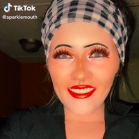 Dia terpaksa menggunakan gigi palsu untuk kesehariannya. Namun Alyssa tidak minder untuk menunjukkan penampilan aslinya tanpa gigi. Foto: dok. TikTok