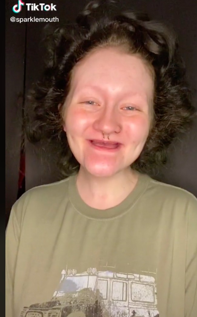 Influencer bernama Alyssa Segrist ini kerap menunjukkan transisinya sebelum dan sesudah makeup. Dia jadi viral dan mendapatkan sorotan karena tidak punya gigi dan alis. Foto: dok. TikTok