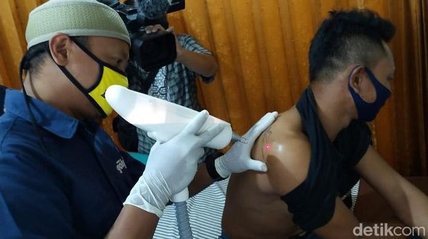 Proses penghapusan tato di Komunitas Go Hijrah