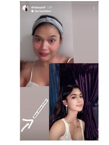 Dinda Syarif setelah operasi jakun.