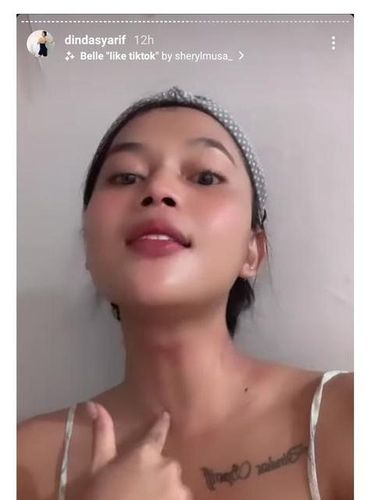 Dinda Syarif setelah operasi jakun.