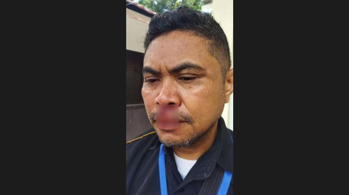 Seorang wartawan, yang juga Pemred Suaraflobamor, Fabi Latuan, Selasa, 25 April 2022 dianiaya orang tak dikenal di seputaran wilayah Kelurahan Naikolan, Kota Kupang, Nusa Tenggara Timur (NTT).