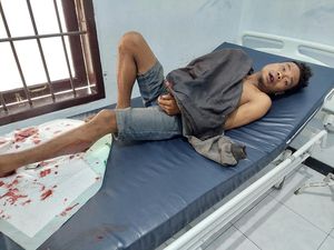 Polisi Tembak Buron Pemerkosa Gadis Disabilitas di Kupang