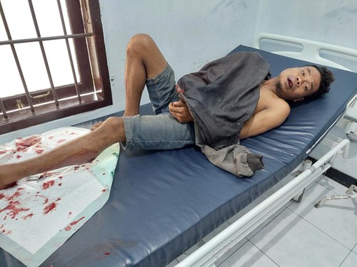 NT, DPO pemerkosa gadis disabilitas di Kupang saat tergolek usai ditembak polisi karena melawan saat hendak ditangkap.