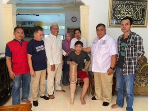 Andre Rosiade Hadiahkan Kaki Palsu untuk Eks Bintang PSP Padang U-13