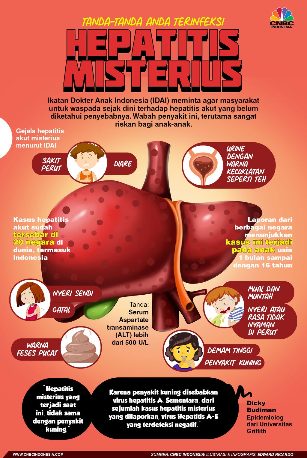 Infografis, Tanda-Tanda Anda Terinfeksi Hepatitis Misterius